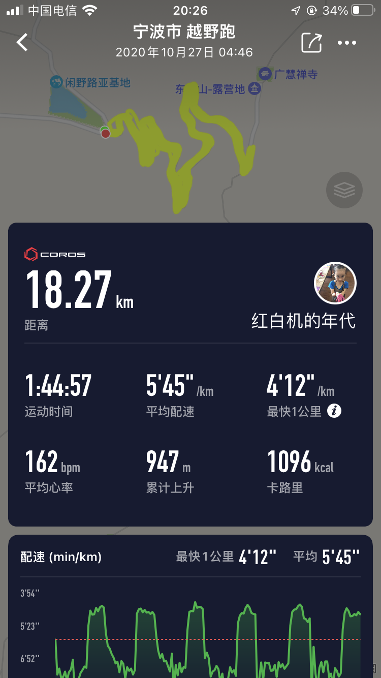 D7C48304-E103-4A7F-820C-02FE3E00F0E4.png